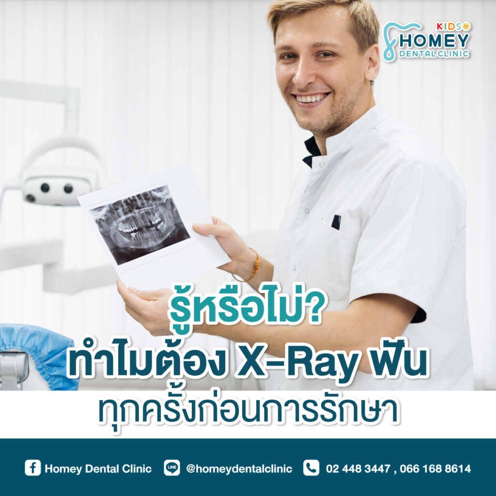 X-Ray ฟัน