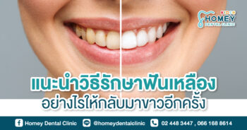 แนะนำวิธีรักษาฟันเหลืองอย่างไรให้กลับมาขาวอีกครั้ง