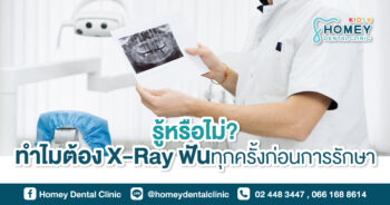 X-Ray ฟัน