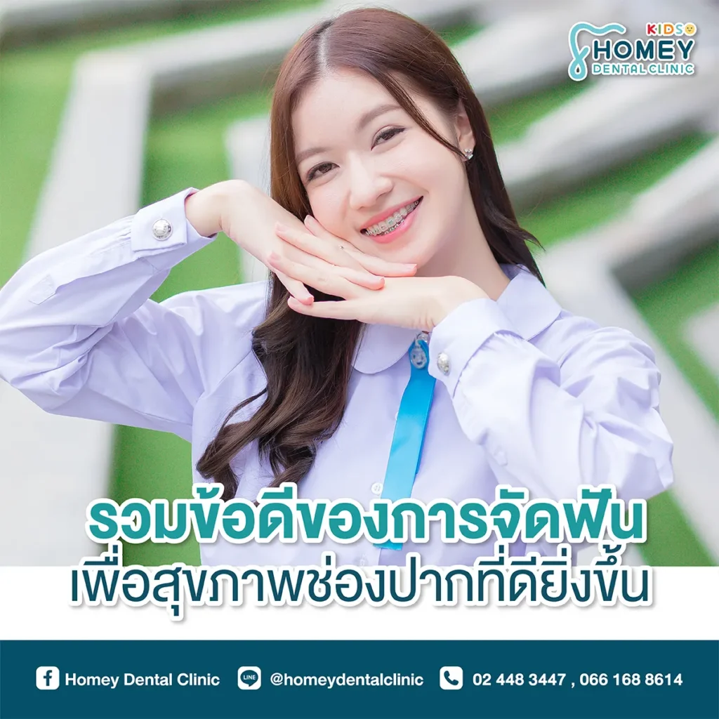 ข้อดีของการจัดฟัน