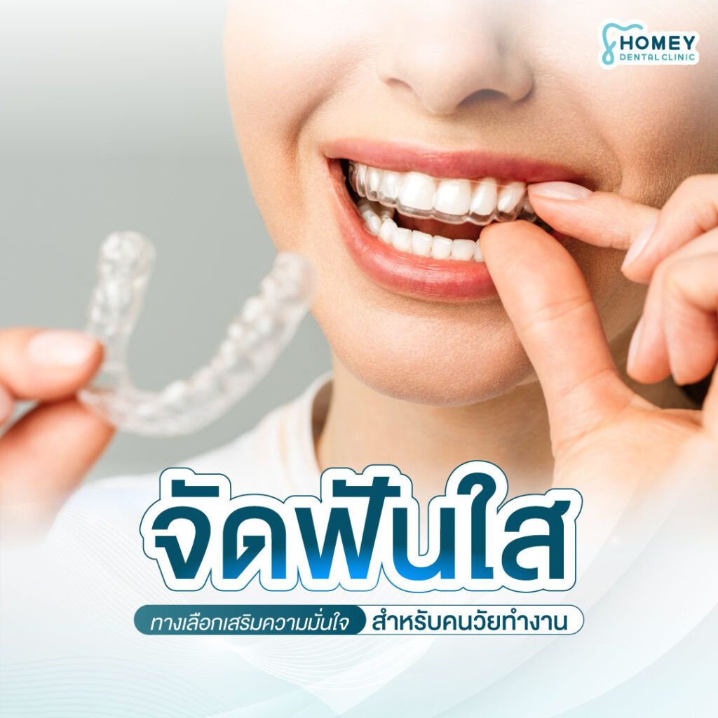 การจัดฟันแบบใส